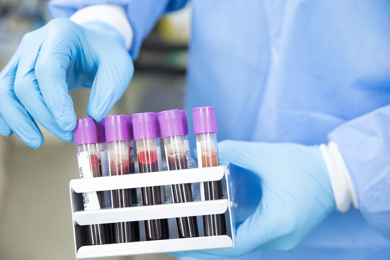 sample, lab, laboratory, scientist, medical, health, test, science, healthcare, research, tube, blue health, blue medical, blue science, blue research, blue lab, blue test, blue blood, blue laboratory, blue healthcare